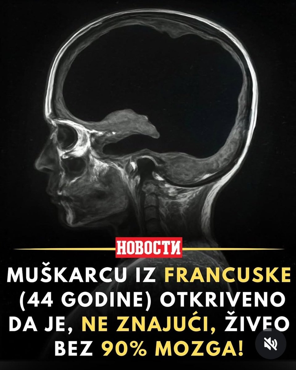 Tako naš narod živi već godinama, nažalost.🧠