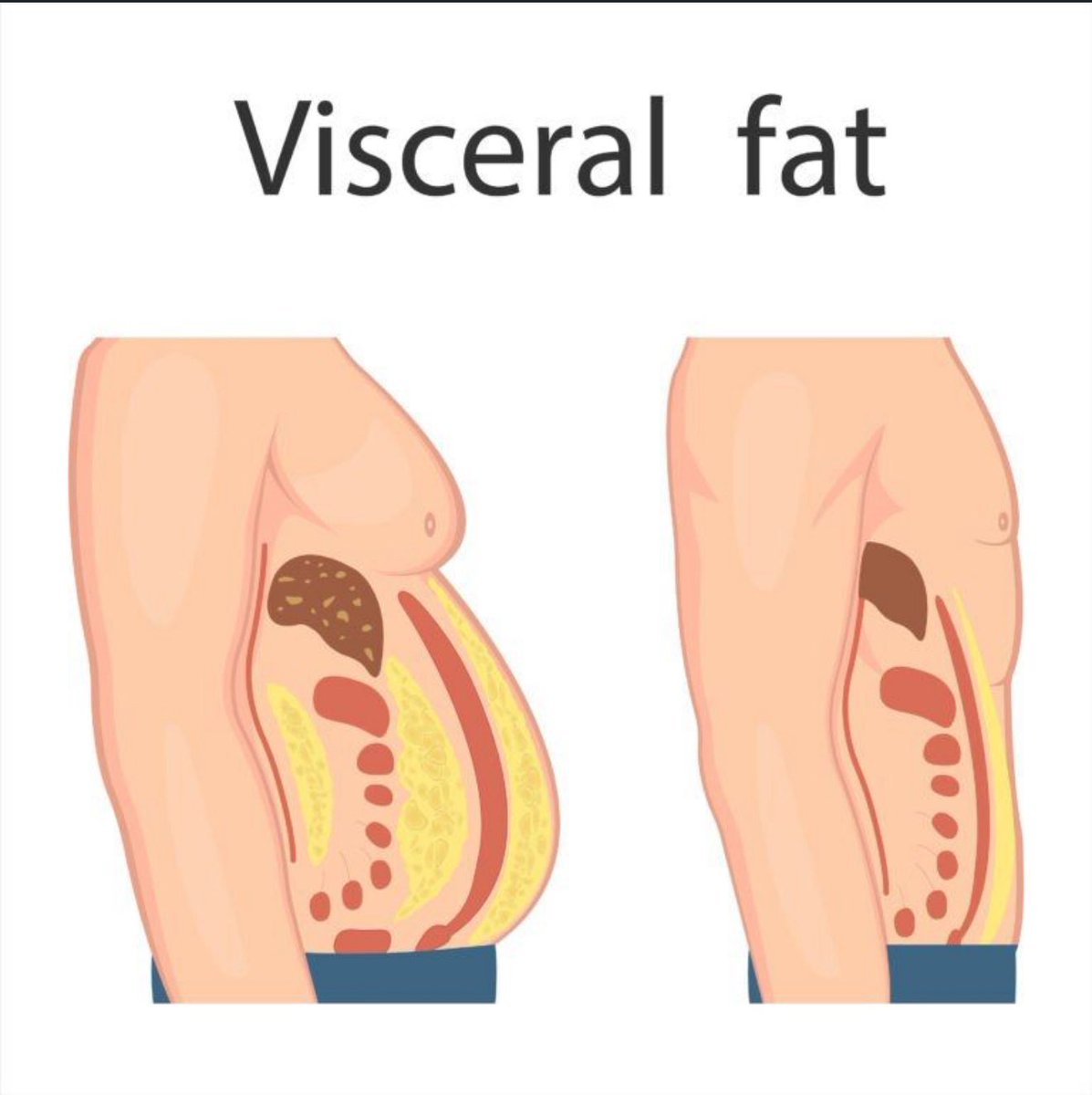 linkedin.com/posts/andrewpa…