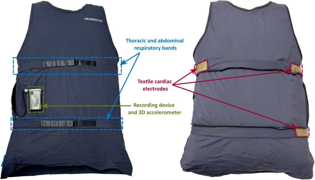 GizmoMD_'s tweet image. Smart shirt uses AI to detect epileptic seizures in real time - gizmo.md/2025/11/10/sma… #medtech