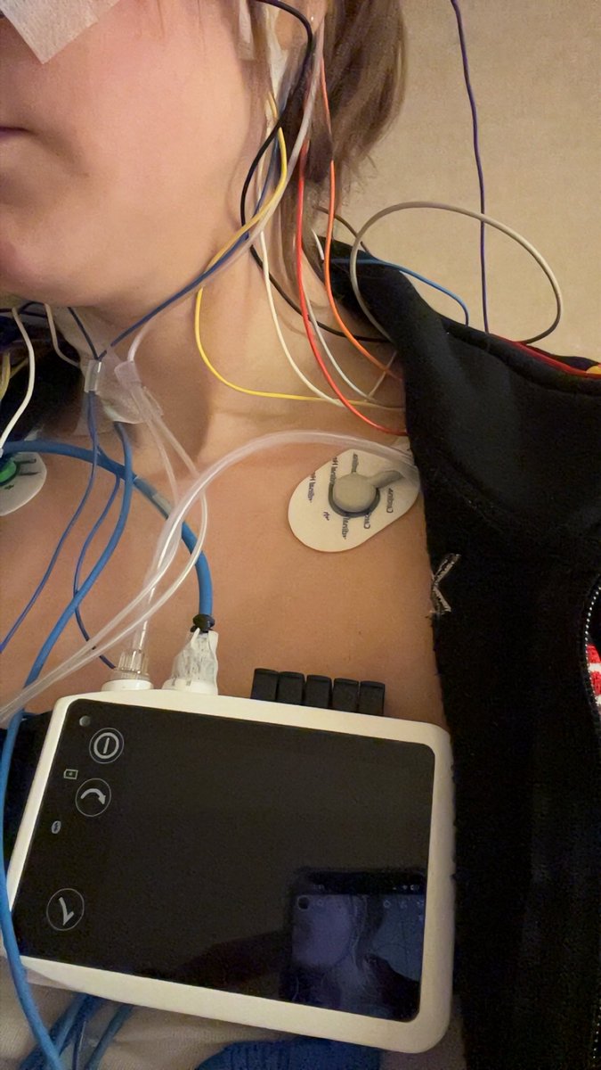 Kiimmie33's tweet image. Just another glamorous night of beauty sleep… wired edition ⚡ Joining the cyborg army 🤖 #SleepApneaTest