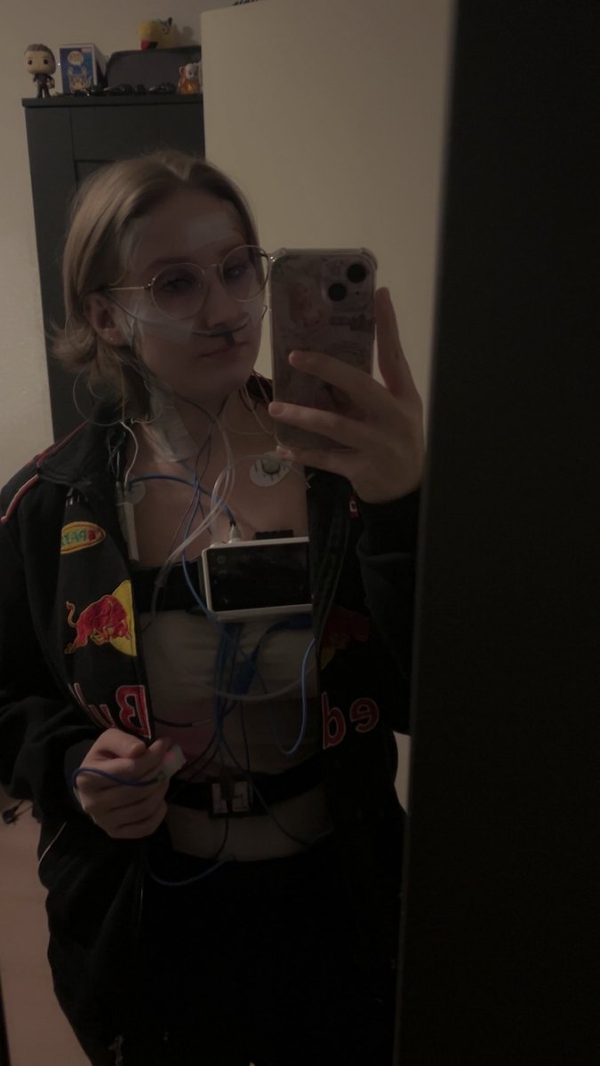 Kiimmie33's tweet image. Just another glamorous night of beauty sleep… wired edition ⚡ Joining the cyborg army 🤖 #SleepApneaTest