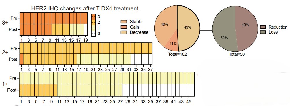 Now online in <a href="/CD_AACR/">Cancer Discovery</a>: Trastuzumab Deruxtecan (T-DXd) Resistance via Loss of HER2 Expression and Binding - by <a href="/WanyiChenIvy/">Wanyi Chen</a>, <a href="/JoshDragoMD/">Josh Drago</a>, Sarat Chandarlapaty, and colleagues doi.org/10.1158/2159-8… <a href="/MSKCancerCenter/">Memorial Sloan Kettering Cancer Center</a>