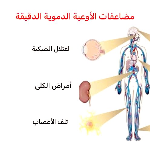 You9F_'s tweet image. ✨للمصابين بالسكري

التحكم المكثف في مستويات السكر (تراكمي أقل من ٧٪) له فوائد كبيره من ضمنها:

🔺خفض خطر مشاكل الشبكية بنسبة ٧٦٪
🔺خفض خطر مشاكل الكلى بنسبة ٥٠٪
🔺خفض خطر مشاكل  الأعصاب بنسبة ٦٠٪