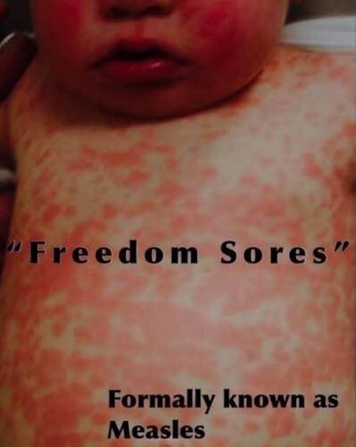 Thanks to #MapleMaga

Champions of ‘Freedom Sores’

Way to go idiots.