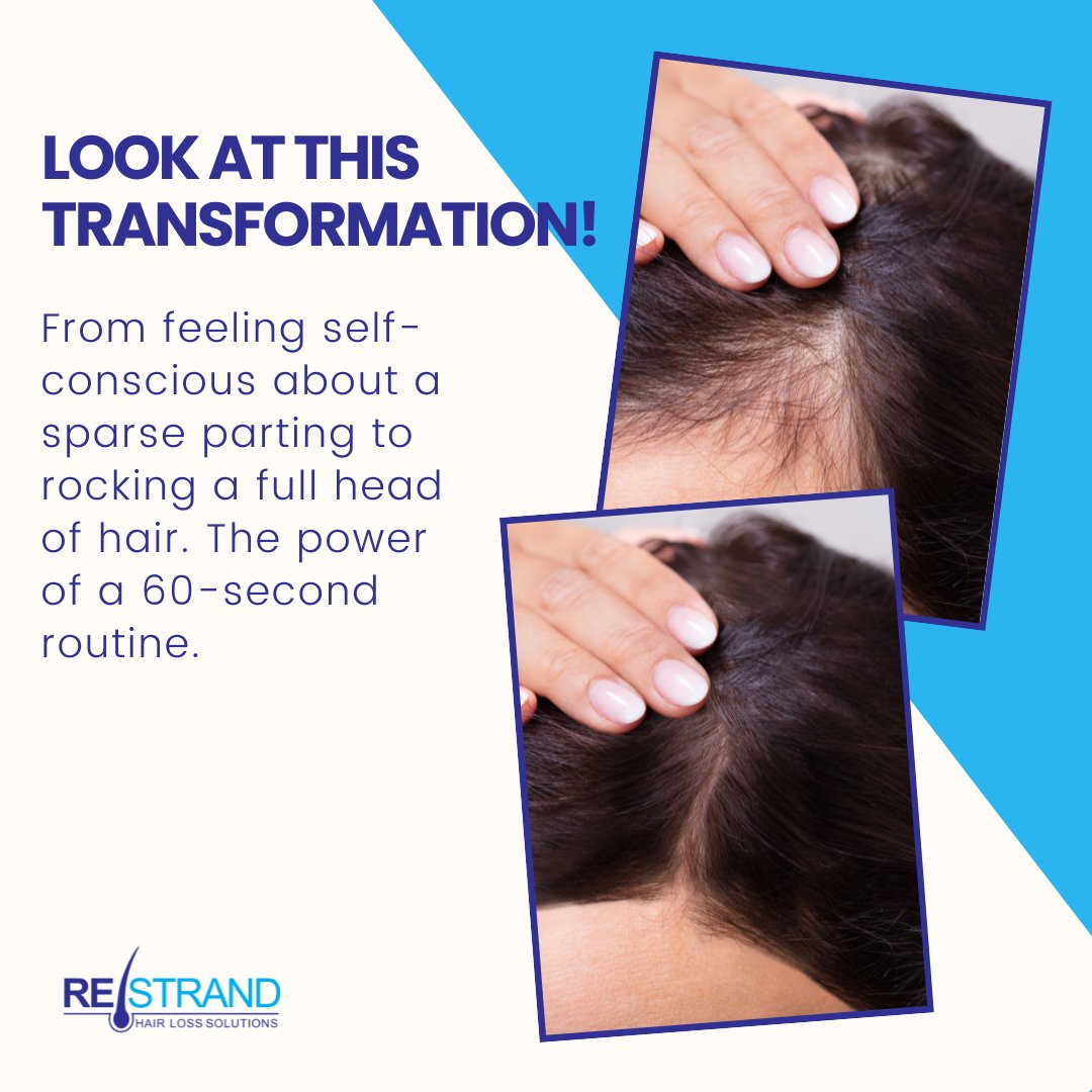 RESTRAND's MD. tweet media