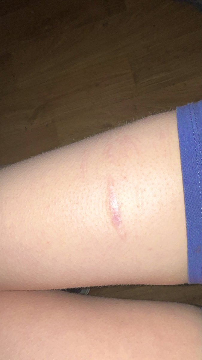 why is my scar growing 🧍‍♀️#shtwt