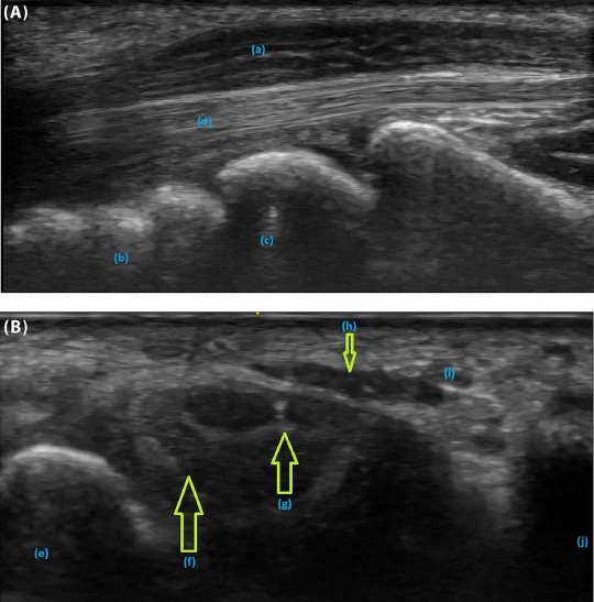 Journal of Neuroimaging tweet media