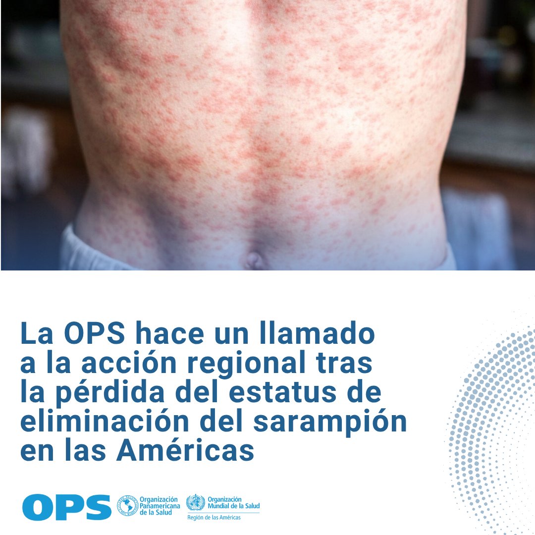 opsoms's tweet image. 🔴 La OPS anunció hoy que la Región de las Américas ha perdido su estatus como región libre de transmisión endémica del sarampión.

Esto ocurre debido a que la transmisión endémica del sarampión se ha restablecido en Canadá.

🔗: paho.org/es/noticias/10…