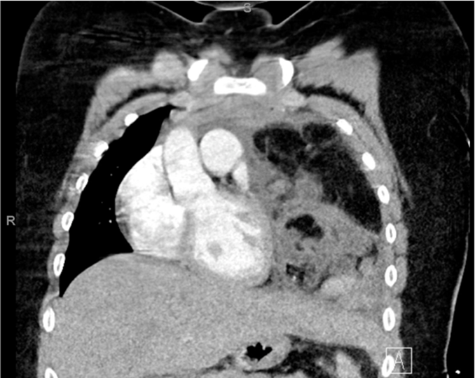 American College of Radiology tweet media