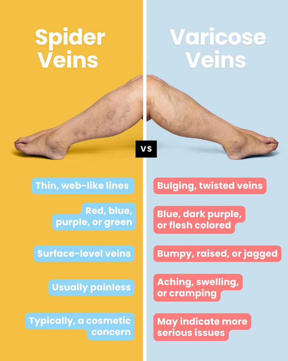 metrovein's tweet photo. Did you think spider veins and varicose veins were the same thing? You’re not alone. Both are signs of vein disease—but they look and feel very different.
.
.
.
#VeinCare #VaricoseVeins #SpiderVeins #VeinTreatment #HealthyLegs #painfreetreatment https://t.co/M4yRAT85lN