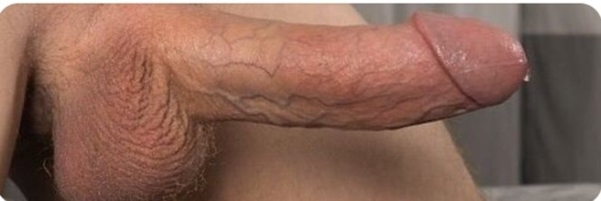 David U lucky tweet media