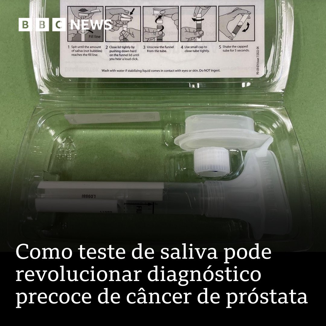 Teste de saliva pode ajudar a "virar o jogo" do câncer de próstata, afirmam cientistas britânicos

Exame analisa o DNA dos homens para descobrir quem nasceu com maior risco de desenvolver a doença: bbc.in/3WJvHR2 

#ArquivoBBC