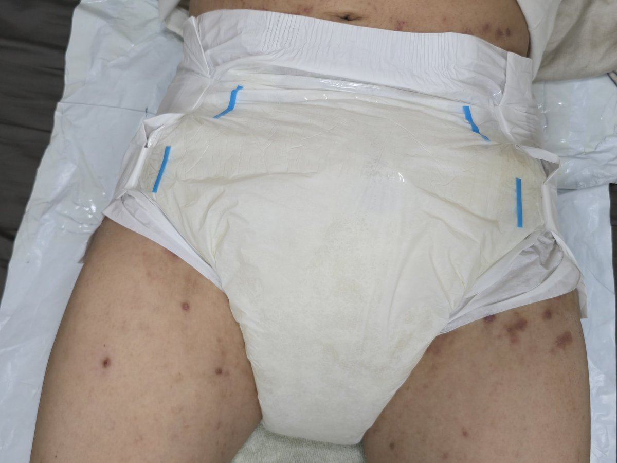 KHHDiaperLover's tweet photo. 天氣轉涼，適合包布布了 https://t.co/DmexVMV5WH