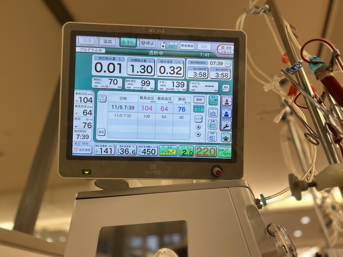 beta_a1944's tweet photo. 8月後半から高血圧ぎみで投薬開始。ここ最近落ち着いてきたかな？って思ってたら、透析中の血圧��で下がっちゃいました。

血圧管理は本当に難しい。血圧の落差でも特に���怠感はないのは、スーパー30ゴールドのおかげだと社員としての忖度無しで思ってます( *'ω'*)و ｸﾞｯ
#透析　#スーパー30ゴールド https://t.co/RSc4Gzonri