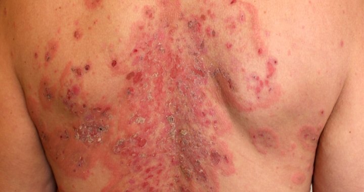 ahmedziaddd's tweet image. Hello, Ahmed&apos;s condition is very critical. Can you help him? He&apos;s in a critical state. Can you donate to save his life? Please don&apos;t hesitate. gofund.me/0ceed39a