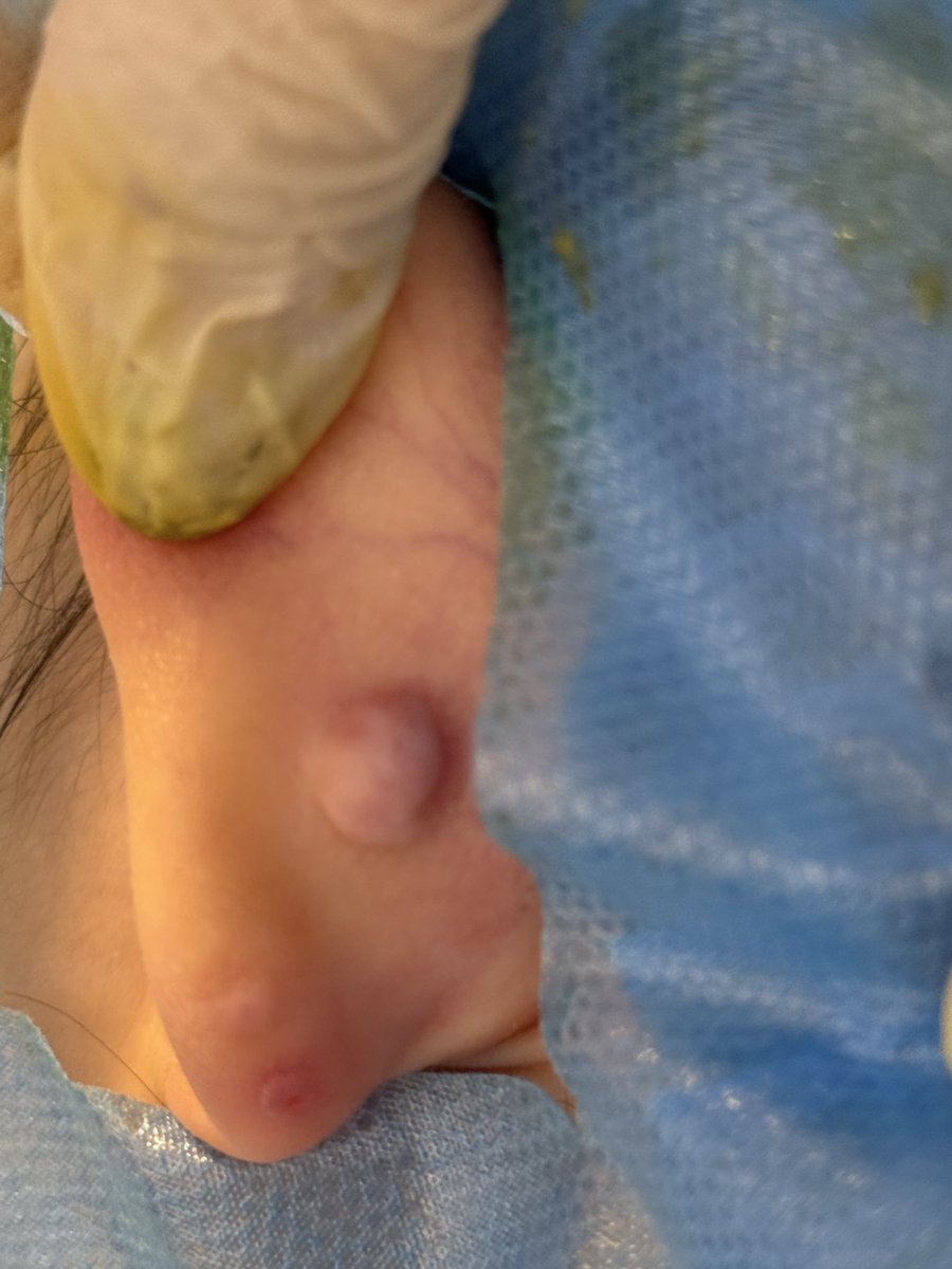 苏州无闷董得都懂 分舌 入珠 tweet media