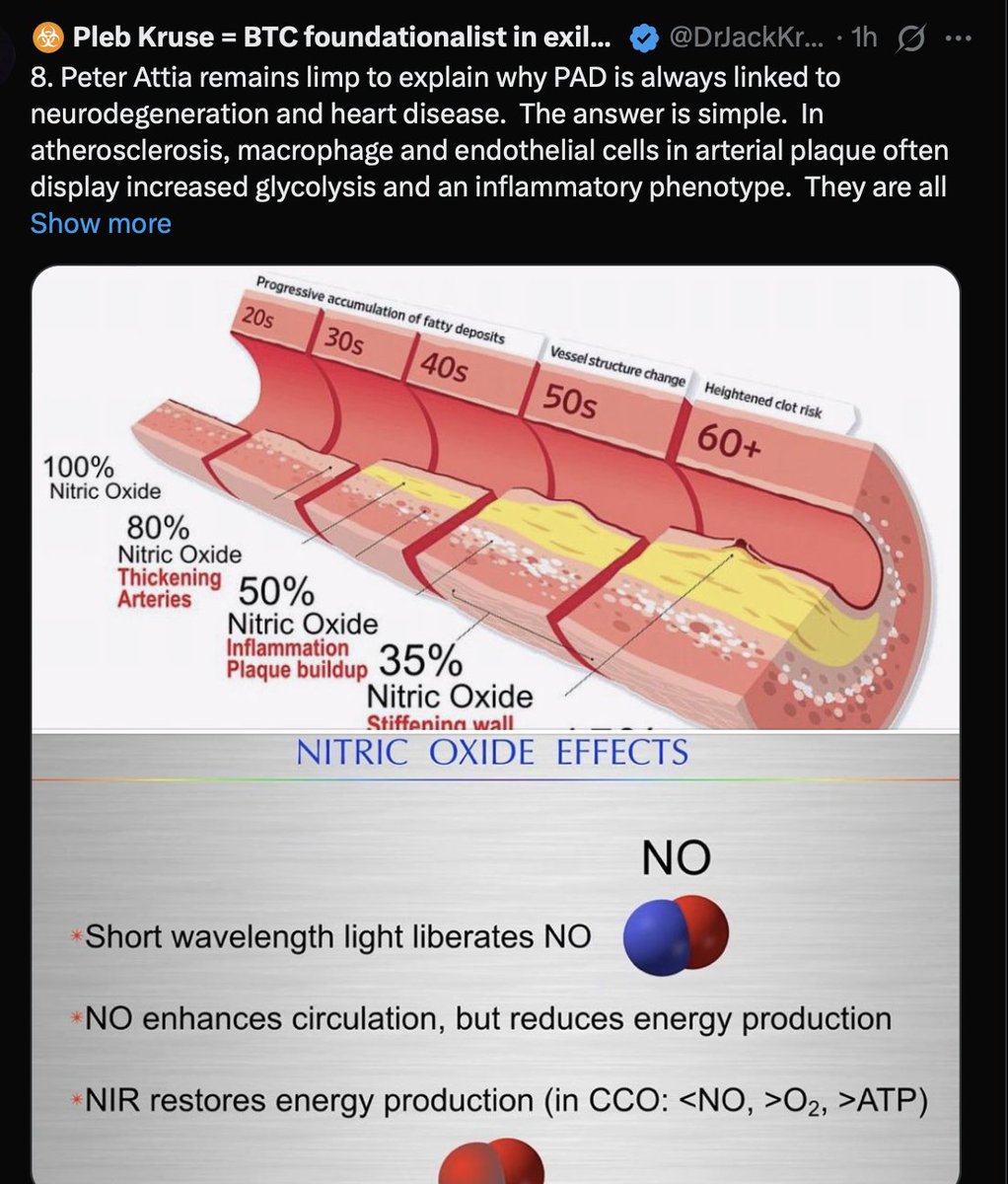 DrJackKruse's tweet photo. LOL.  Seems like the fitness gurus, meat heads, and the centralized doctors do not understand the basics.  When your body is jeweled by nnEMF and your work outs are in blue light fueled by carbohydrates this is exactly what one should expect.  Why?  

DARPA research on the elite soldiers shows most of them fail when using cold.  

Why?  

This is gonna take a while to explain........Google triathalon deaths or cardiac death in winter so you understand why this understanding the context is critical. 

In winter in most places there is a paucity of UVA and IRA light.  This limits photorepair and limits melanin creation from POMC translation. This stresses the melatonin/cortisol/dopamine/ATP system. 

When you do your due diligence, you'll notice that triathalon deaths occur mostly during the swim or immediately after it. Why is that? 

Winter the cooling have a link. It is the same reason you face your seasonal demise but how it happens in you is a bit different. These athletes are all carb adapted not just do to their diets, the light environment they train in raised blood glucose and insulin.  Cold also increases blood glucose.  This behavior occurs because of their beliefs tied to performance. 

This changes the protein confirmations on most of the proteins used in the mitochondria. The cytochromes being the most important where quantum tunneling occurs. Once electrons are tunneled they head toward oxygen to reduce it. The inner mitochondrial membrane also water micelle's around it (MINOS) they have polarized water around it that contain's protons. The matrix has protons in it that are transfered to the ATPase to make ATP. Many of them are not protium, but are deuterium.  This causes ATPase to fail. 
 
When they are in a summer season or warmer environment their proteins have a certain confirmation bend because they are dehydrated from the task but also because they are living off carbs 90% in nnEMF of the time. This dehrated their proteins in cells and cause acute delta psi collapse.  
In the warm environment it is not a problem for them because they are recycling ATP easily because UVA and NIR light act to reduce ATP stoichiometry via the faster  pathways you learned about in my EMF 4 blog. IR-A light also can augment ATP production because CCO allows the IMM to make water that is DDW.  Carb use from food or light create only 50% of the DDW that fats do. Remember the what I taught you in the Energy and Epigenetic series. 

As temperature goes rises in cells,  entropy increases in a system. DDW is less efficient so when entropy increases, water density drops. 

This changes how water can work with sunlight. When water density is less, the water contains less oxygen therefore the cell sense hypoxia.  There are fewer electrons because light is not splitting water using melanin. When oxygen tensions are lowered less ATP is made and more light is relesed from cells in UPEs.  This light is noise and not signal.   When oxygen is lowered it cause methylation defects via TET enzymes. This means that in a warm environment you are running more hypoxic and you perceive a need for carbs to offset this set of circumstances to run a faster stochiometry to make energy. 

Could UVA and IRA light help this? Yes, but this is not always possible during the swim when people have most of their body covered up by a body suits for sponsors in the colder water. As long as all those conditions stay the same the body and system adapts properly. When they hit the water or cold temperature they immediately leave a warmer environment during the run or the bike ride........This radically changes the situation to the living system. Remember what I taught you from the CT series. In water heat transfers occur 24 times more quickly than they do in air. This means rapidly UPEs change our physiology.  The sensory systems in the PNS are all designed from an evolutionary standpoint to respond to transient environmental changes and not a rapid change.  The same thing is true with the circadian clock genes.  This is the essence of sensory receptor adaptation in humans. 
This is where the shit begins to hit the fan for the athlete or person in cold when they are carb adapted or not getting enough solar exposure during this transition. The cold receptors sense the transient change and send it to the brain and the mitochondria in coherent water. The water surrounds the mitochondrial membrane. This temperature change changes the molecular arrangements of proteins and fats in the outer and inner mitochondrial membrane. It also changes the molecular structure bonding angles, and the rotations of the bonds in these molecules. This implies there is electronic, molecular, and rotational changes in these proteins to alter its function in a quantized fashion. This changes UPE emission from mitochondria

So the tissue, specifically their mitochondria, begin rapidly to sense this "change in matter" and the proteins and water around the mitochondria react in quantum fashion to this change. But what can not happen in these people? They need ATP to unfold their new protein confirmation to bind more water inside the cell to meet the new environmental demands. They can not do it for two reasons. They are dehydrated and they do not have the ability to make enough ATP to match the protein and water changes inside the cell to the radical temperature change, so what happens? They make less ATP and transfer less energy via the water micelles and this all accelerates the process of hypoxia. Another big thing happens. In temps below 62 degrees insulin no longer works in a mammalian cell. If you have no insulin you have no way to work the Krebs cycle to bring metabolic intermediates to the mitochondria. Since all they eat is carbs and protein they have no substrate ready to make ATP. So the cold alone, runs them dry of energy substrates to make ATP very quickly because of their mismatched fuel choices. Since they are in cold water they cannot use IRA light to augment this loss either. The cold water hastens this demise in tissue with mitochondrial density. This is why ketosis is linked with cold temps in nature all the times. As it steepens their muscles begin to hurt but eventually it alters their ability to think because they just think this is a temporary thing they experience from the grueling race. Soon their heart/brain become starved for O2 while they continue the swim. The environmental signals are massive because of the way heat is transferred in water so rapidly. When they emerge from the water the environment changes just as drastically back to the warm........from cold. They have an immediate spike in oxygen reduction in the face of a cytosol and mitochondria now adapted to severe hypoxia. This is the ultimate environmental mismatch that their body is not prepared for on such short time scales. It mimics an acute circadian mismatch to light. When this occurs, oxygen becomes toxic as the hydroxyl free radical.......I taught you about this in the Sept webinar of 2013. When this happens it immediately changes the ability to quantum tunnel electrons in the cytochrome proteins because they are loaded with transition metals. This immediate causes the ability to make no ATP. The one bail out would be solar light, but people are covered in triatholons. When ATP is not made in the mitochondria it causes a cell to lose its meta stability (read the Q & A October webinar 2013 thread here to get the full impact) and the cell begins to reach true equilibrium. It is no longer able to be far from equilibroium. 

When this happens the brain, heart and skeletal muscles all release water and potassium and become rigid. They can no longer contract and the heart stops in diastolic failure. We call this failing in autophagy. This is precisely how one dies of an AI disease or from sleep apnea. The only difference is the time scales and the temp changes. This can lead to cardiac death or rhythm changes in the heart.  

The science is well known by decentralized clinicians.