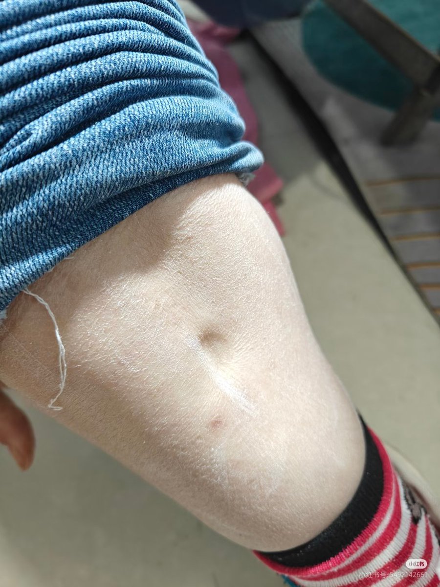 荔枝Q甜(互fo) tweet media