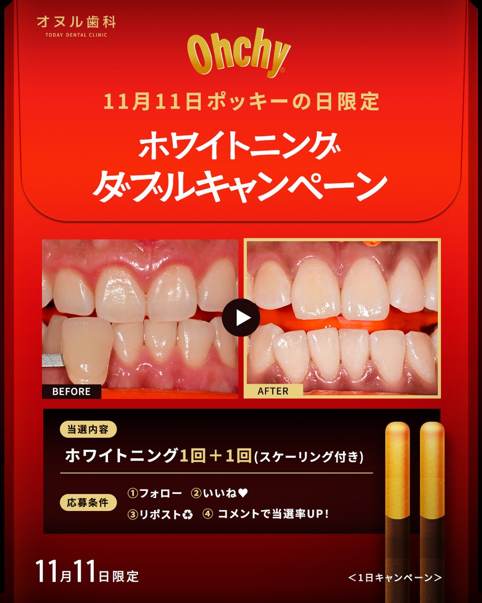 todaydental_jp's tweet photo. ＼韓国ポッキーの日限定！無料当選のチャンス🍫／

参加するだけで“スマイル美人”になれるチャンス💎

ホワイトニングがWで当たる!?✨
ホワイトニング𝟭回＋𝟭回（スケーリング付き）

こでだけでOK！🦷
①フォロー ②いいね❤️ ③リポスト♻️ ④コメントで当選率UP！

🗓 期間：𝟭𝟭/𝟭𝟭本日限定
📩当選者発表: 翌週にてDM送信いたします。

📲ご予約・お問い合わせはLINEへ
https://t.co/q2zlh6tu6F