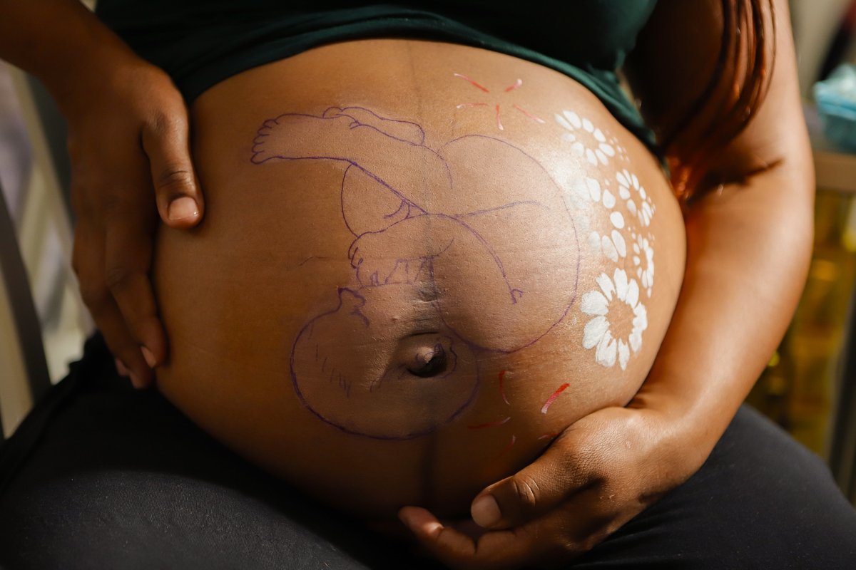 HTLV: conheça essa Infecção Sexualmente Transmissível. O Dia Mundial do Human T-cell Lymphotropic Vírus (HTLV) promove prevenção e diagnóstico precoce, com foco nas gestantes. 

📲Saiba mais: encurtador.com.br/nUvS