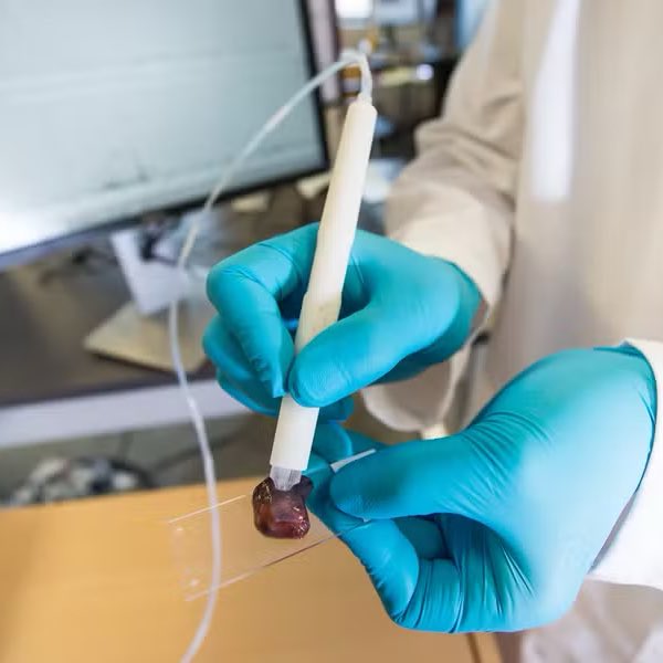 updatecultura's tweet photo. Uma química brasileira desenvolveu uma caneta capaz de detectar CÂNCER em apenas 10 SEGUNDOS, identificando se um tecido é saudável ou cancerígeno ainda durante a cirurgia.

A tecnologia está sendo testada no Brasil, no Einstein. https://t.co/FhRfN3VUWf