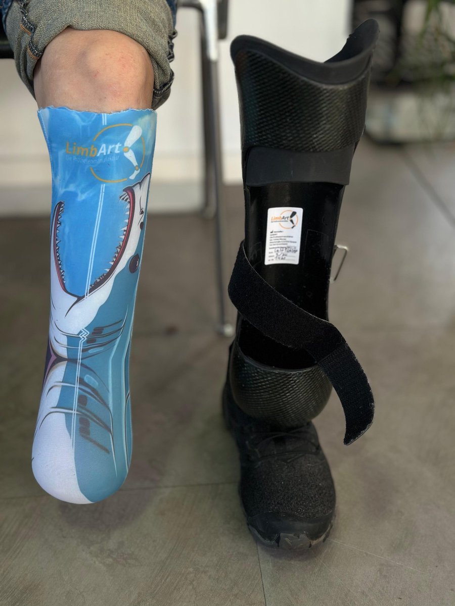 Heute einen neuen Prothesen Liner bekommen, danke @limb_art_prothesenmanufaktur, 

#limbart #motiontech #Handwerk #heißertyp #amputation #Prothese #inklusion