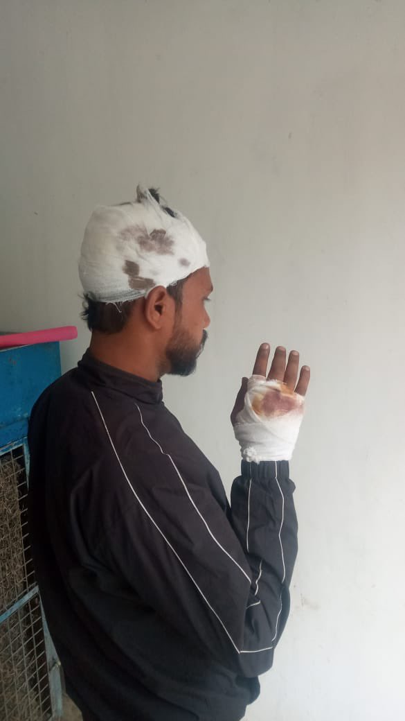 BhimArmyChief's tweet image. अलीगढ़ जनपद के बन्ना देवी थाना क्षेत्र में बहुजन समाज के युवक चंदू लोधी पर हुआ जातंकवादी हमला — अत्यंत पीड़ादायक और समाज को शर्मसार करने वाला है।

ड्राइवर का काम करने वाले चंदू लोधी को एक जातंकवादी युवक ने कॉल कर कहा कि —“दिल्ली जाना है, क्या गाड़ी चलाकर ले चलोगे?” 1000 रूपए…