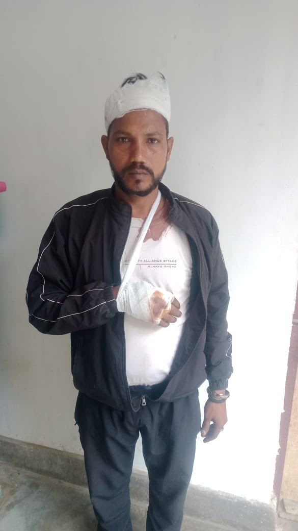 BhimArmyChief's tweet image. अलीगढ़ जनपद के बन्ना देवी थाना क्षेत्र में बहुजन समाज के युवक चंदू लोधी पर हुआ जातंकवादी हमला — अत्यंत पीड़ादायक और समाज को शर्मसार करने वाला है।

ड्राइवर का काम करने वाले चंदू लोधी को एक जातंकवादी युवक ने कॉल कर कहा कि —“दिल्ली जाना है, क्या गाड़ी चलाकर ले चलोगे?” 1000 रूपए…