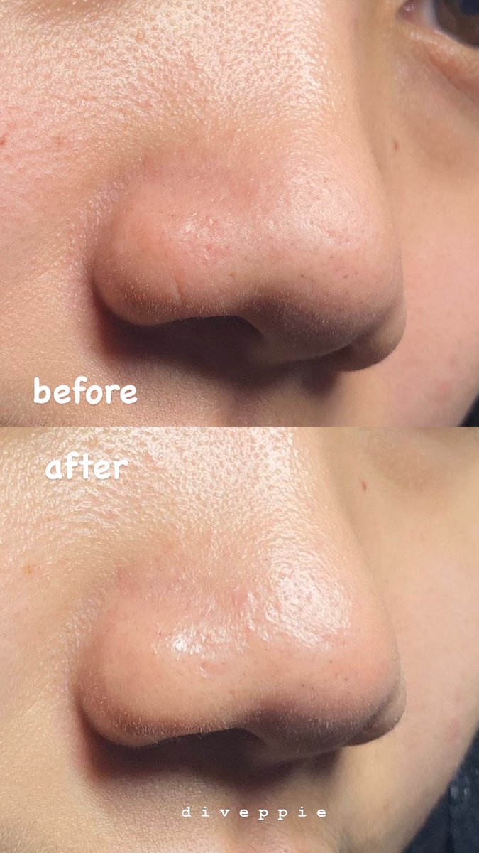 lipuy🌷 tweet media