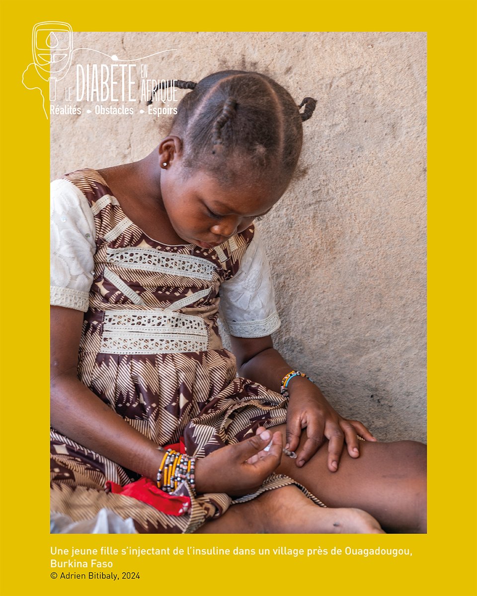 Le #diabète de type 1 touche principalement les enfants et les jeunes adultes mais il peut survenir à tout âge.