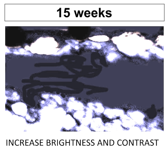 addictedtoigno1's tweet photo. I have written a blog at ForBetterScience. A German lab has published dozens of papers with images that have been scribbled on, or manipulated with the clone tool. Blogs can take a while to read, but maybe scroll through the pictures! Plenty to see! (link in the next comment) https://t.co/3F590MSD0a