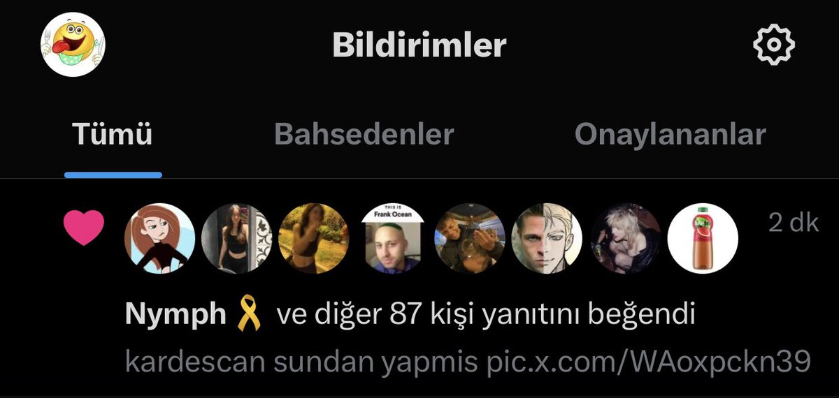 mshm3d's tweet image. sarachanede noluyor amk¿?