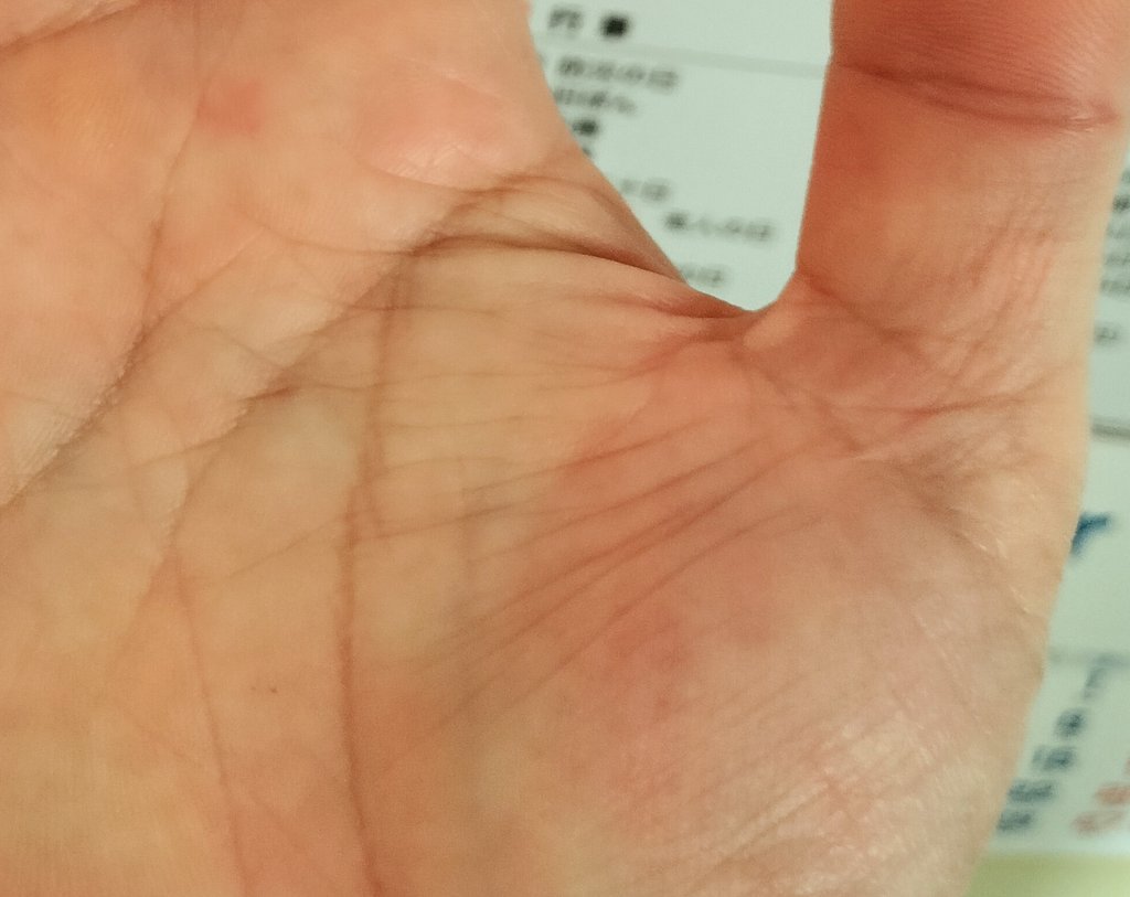 skdjun's tweet photo. 仏眼相は親指第一関節の目状の線で出現率5%の希少相。ひたむきな先祖供養の証とされ、強運・大開運・金運・健康運・人間関係運すべてに恵まれ、直感・霊感が強く、第三の目に関与するとされ、若い時に苦労を積み50歳以降に成功する人が多い。松下幸之助、京セラ稲盛和夫　＃手相学　＃二重神秘十字線 https://t.co/WOI1jgdLYs
