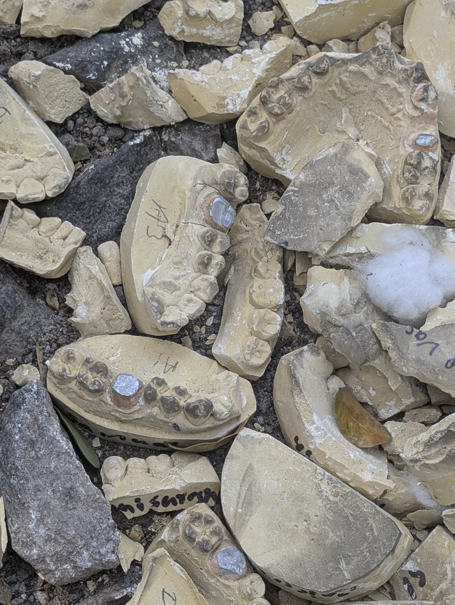 SaumaricDangwa2's tweet image. Bengaluru is not for Beginners: Level 100. 
Someone filled in a pothole in Indiranagar with dentures. Yes, you read that right, dentures! 
You can still see the names of the patients. 🤦🏽🤦🏽

@BbmpEast pls save this mini Mohenjodaro 🙏🏽
#Bengaluru