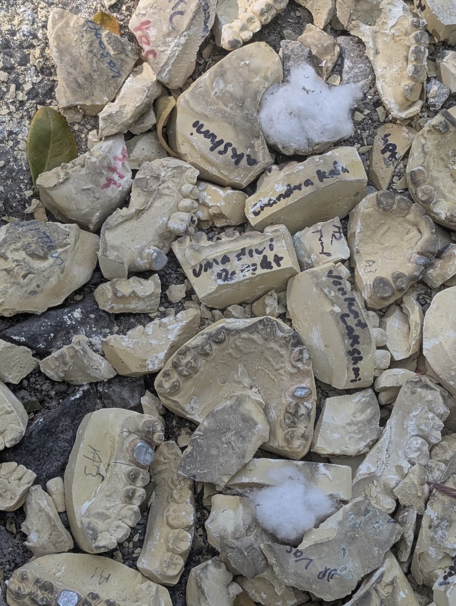 SaumaricDangwa2's tweet image. Bengaluru is not for Beginners: Level 100. 
Someone filled in a pothole in Indiranagar with dentures. Yes, you read that right, dentures! 
You can still see the names of the patients. 🤦🏽🤦🏽

@BbmpEast pls save this mini Mohenjodaro 🙏🏽
#Bengaluru