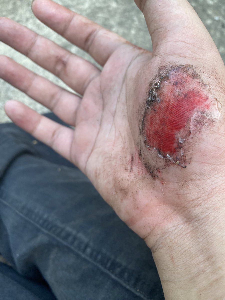 งดคอนเทนสักพักใหญ่ๆคับ รถลื่นล้ม