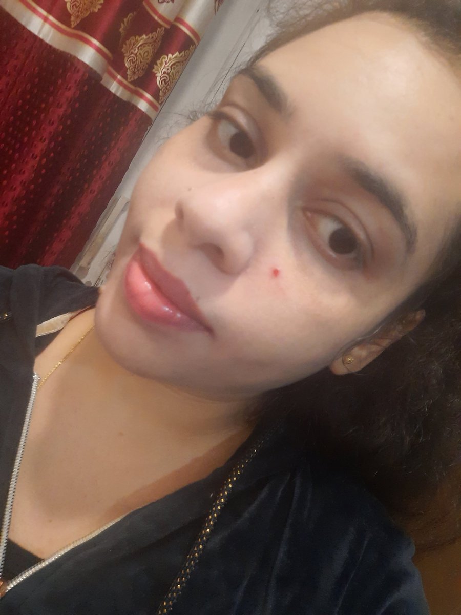 एक छोटा सा पिंपल भी पूरे मूड का हाल बदल देता है 😩

ना छेड़ो इसे, वरना चेहरा नहीं  दिल और ज़्यादा दुखेगा...