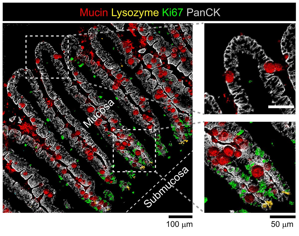 Scientists present a far-ranging biological atlas that captures the fundamental immune and cellular dynamics that drive gastrointestinal, acute graft-versus-host disease (#GVHD) at a single-cell resolution. <a href="/leeat_keren/">Leeat Keren</a> <a href="/WeizmannScience/">Weizmann Institute</a> scim.ag/3LzSqwv