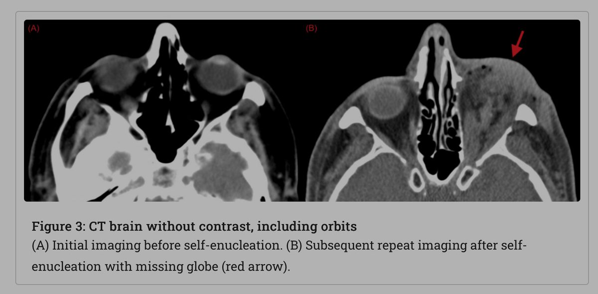 reuben strayer tweet media
