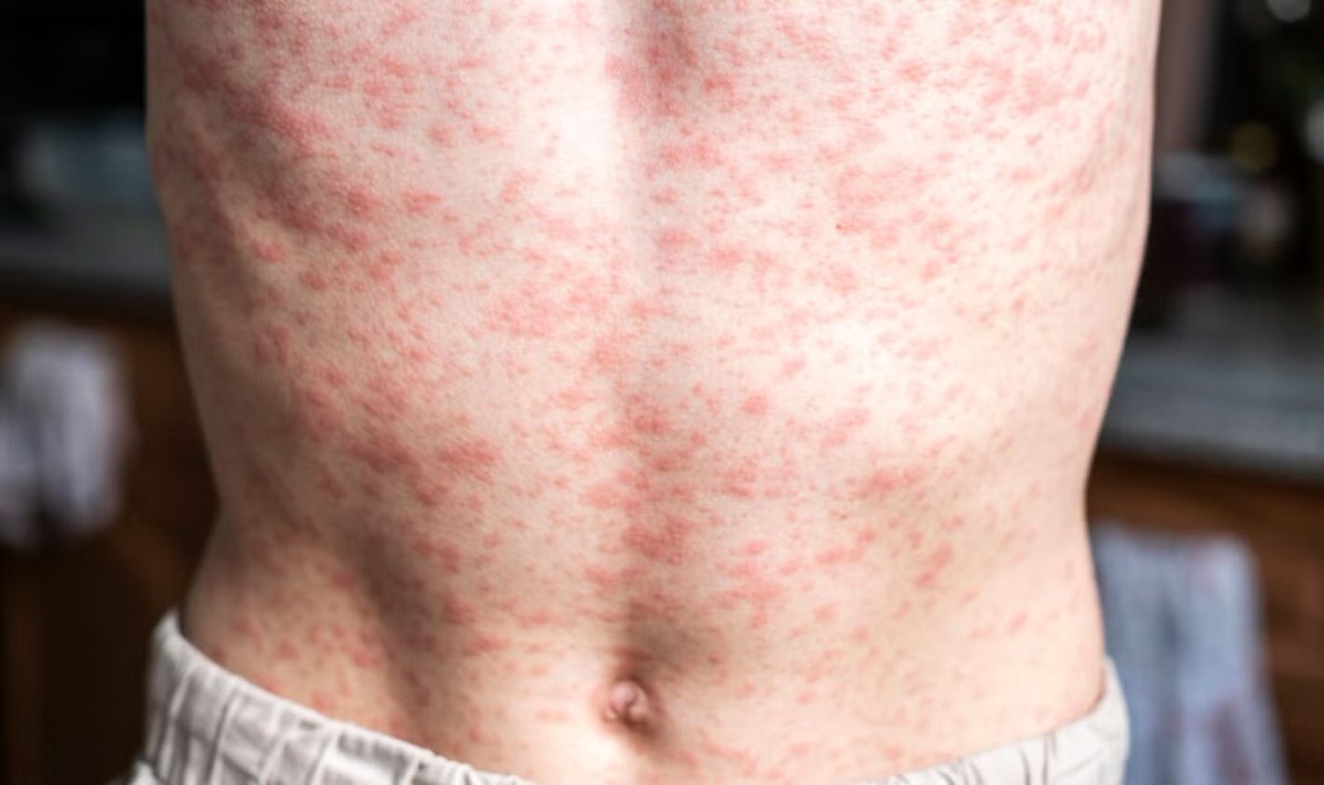 Vacunas.org tweet media