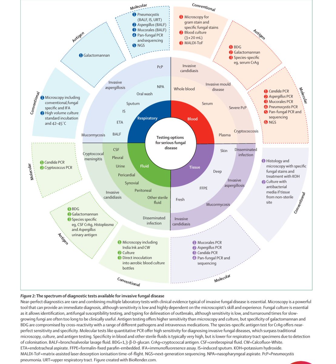 ABsteward's tweet image. 🔥Just published🔥 @TheLancetInfDis
British Society for Medical Mycology best practice recommendations for the diagnosis of serious fungal diseases: 2025 update #IDXposts
Thanks @Inox94
thelancet.com/journals/lanin…