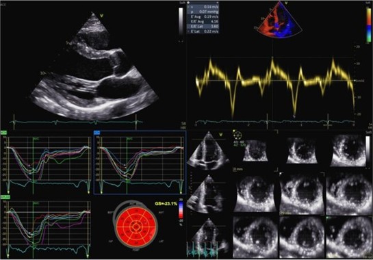 _anmco's tweet image. Metodiche di imaging nel real-world per di migliorare la sicurezza degli atleti: opportunità e limiti
👉 cardiologianegliospedali.it/imaging-nel-cu…