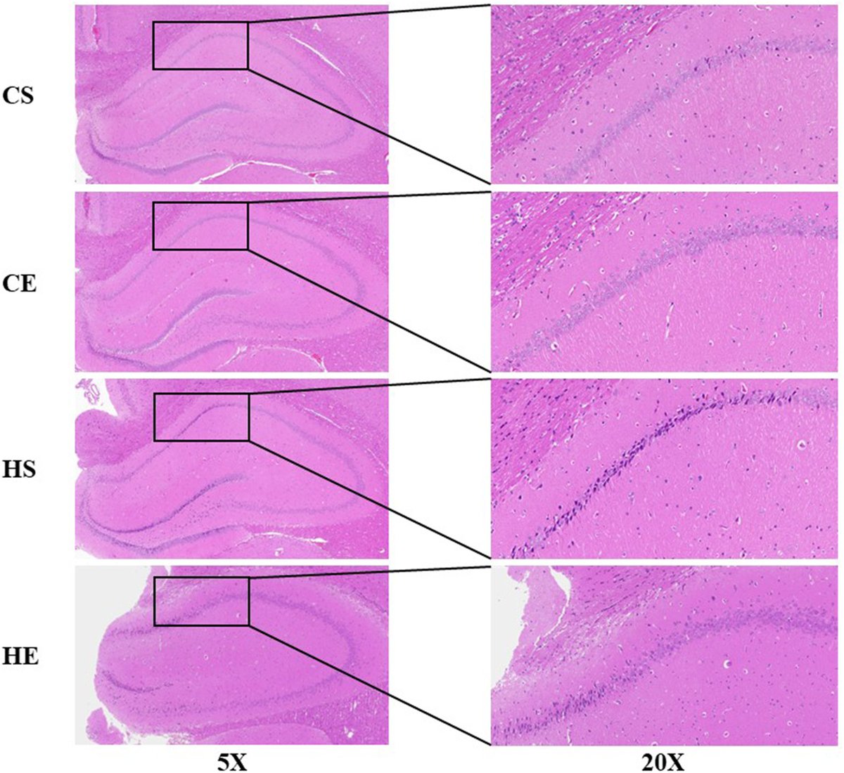 agingdoc1's tweet photo. Effects of 8-Week High-Intensity Interval Training Intervention Regulating the SIRT1/PGC1α Pathway on Hippocampal Neuron Injury and Cognitive Impairment in Obese Rats

🔎"This study findings are consistent with previous research findings, which demonstrate that obesity leads to hippocampal neuronal damage and cognitive decline in behavior. Subsequent exercise intervention experiments found that 8-wk HIIT reduced the weight and Lee index of obese rats, ameliorated their cognitive behavior and neuronal pathology levels, and increased the expression of Sirt1 in the hippocampus of rats. Further protein-level experiments in hippocampal and prefrontal cortex tissues revealed that the SIRT1/PGC1α pathway was significantly downregulated under the influence of obesity, whereas HIIT activated the SIRT1/PGC1 α pathway to ameliorated cognitive dysfunction induced by obesity in rats."

https://t.co/w2kaotAgtO