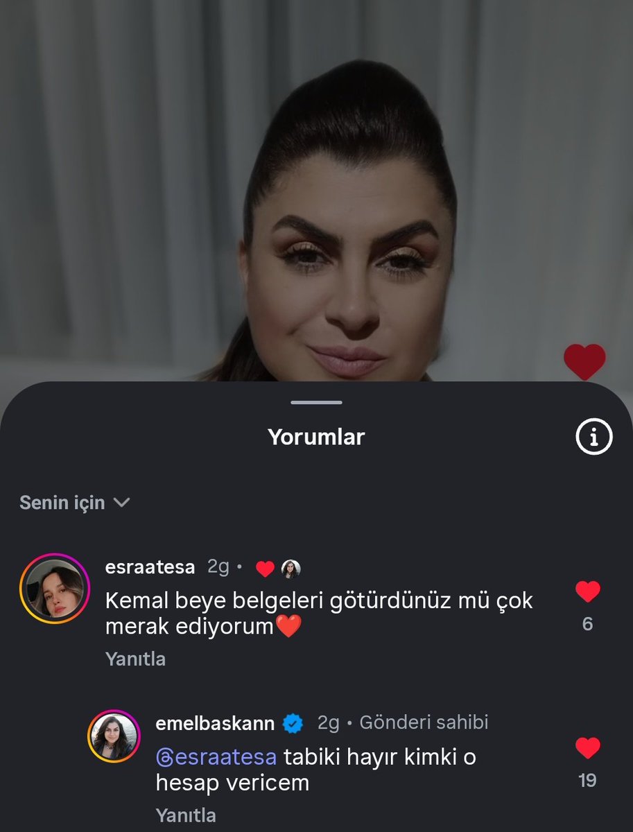 tsnzzzgl's tweet photo. Kraliçe https://t.co/yX9Novlr5A
