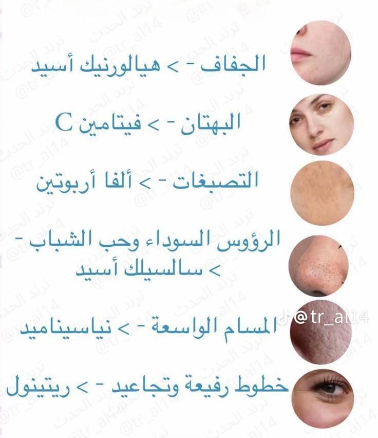 mshaa3r_Q8's tweet image. مشاكل البشرة والسيرومات اللى تناسبها 💫♥️