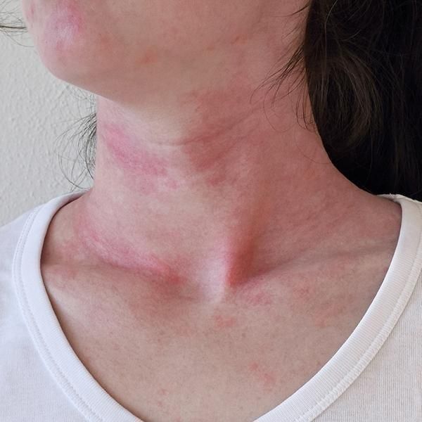 Edvige Ann (@cramberries_) on Twitter photo 