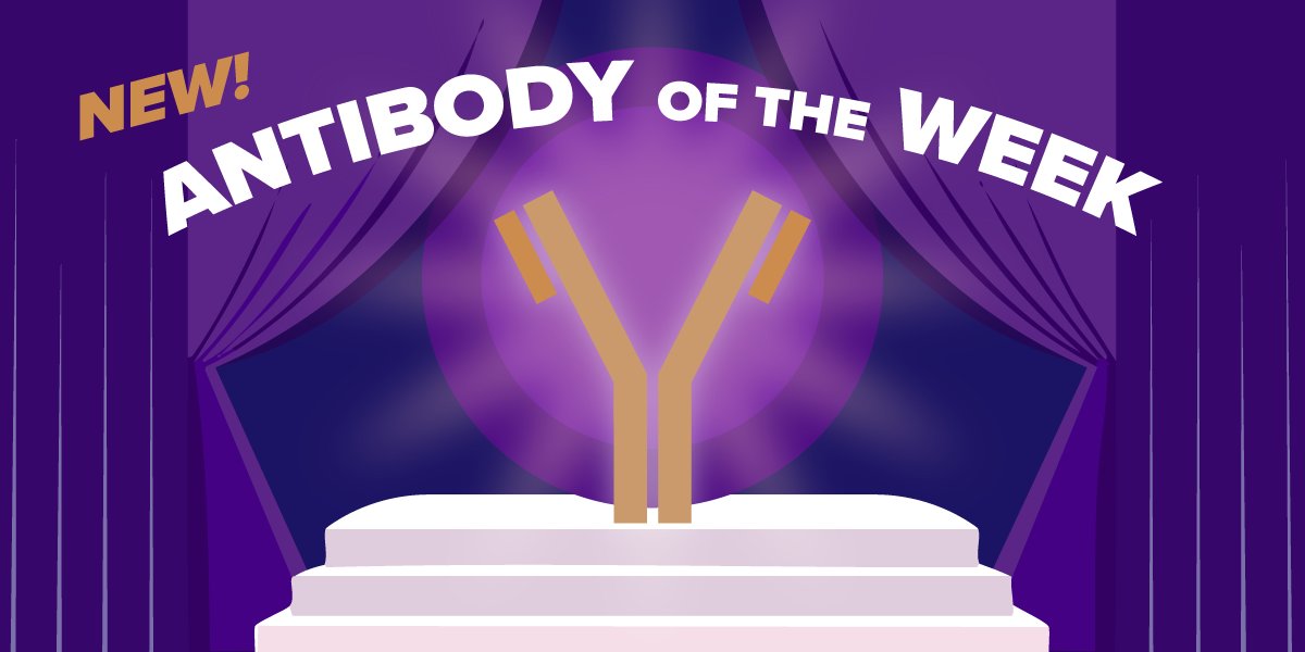 activemotif's tweet photo. 🔬 Antibody of the Week: AbFlex® PLK1 antibody (rAb)
Meet our AbFlex® PLK1 antibody, part of our AbFlex recombinant antibody (rAb) collection [https://t.co/Hxs8rUbH53]
_______
#AntibodyOfTheWeek #Epigenetics #ActiveMotif #AbFlex #PLK1 #RecombinantAntibody #Research https://t.co/PeFWyACTYP