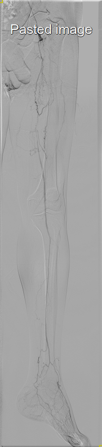 IR_Tech96 tweet picture