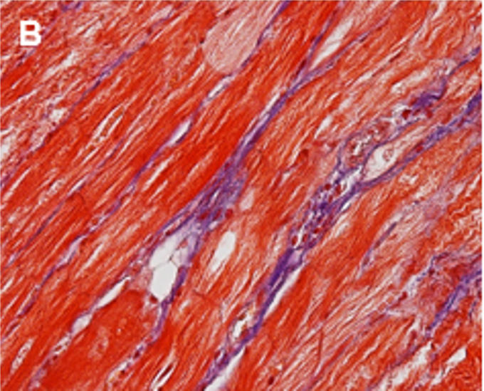 JHCnews's tweet image. Read the latest in JHC: &quot;Immunohistochemical Assessment of Cardiac Macrophages in the Aged Fischer 344 Rat.&quot;     

Click to read: bit.ly/4qvjnl8 

#immunohistochemistry #extracellularmatrix #macrophages