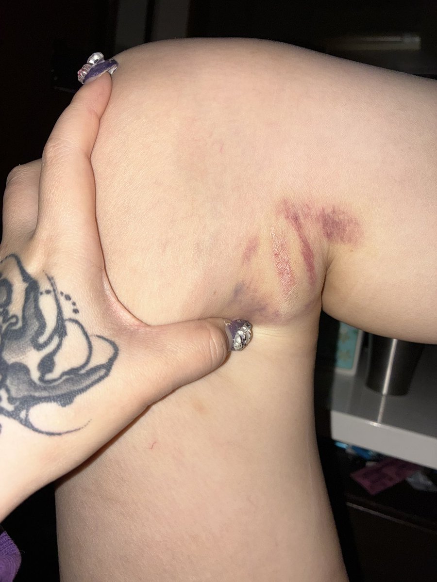 Lilスノザキ希死念慮 tweet media